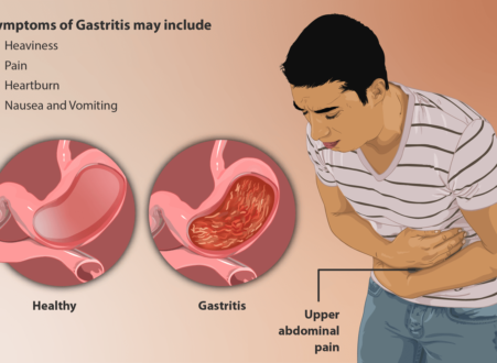 Gastritis.png