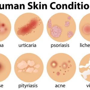A Set Of Human Skin Conditions Illustration