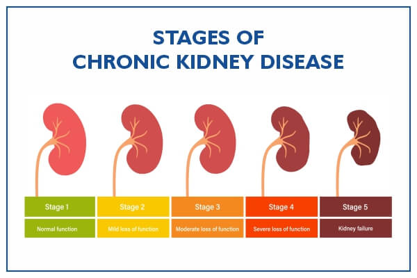 Kidney Disease/ Failure – Store: Shreeja Homeo Clinic